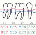 The Perioscopy System: Part 2 - Dentristry IQ